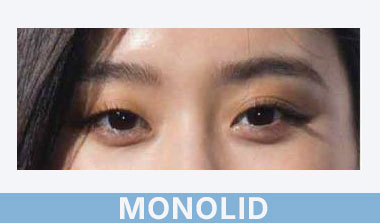 monolid eye shape