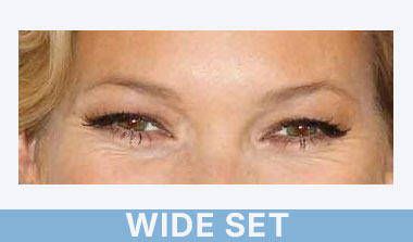 wide-set eye shape